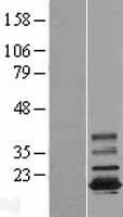 TMEM11 Protein - Western validation with an anti-DDK antibody * L: Control HEK293 lysate R: Over-expression lysate