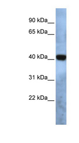 TMEM115 Antibody - TMEM115 / PL6 antibody Western blot of Fetal Brain lysate. This image was taken for the unconjugated form of this product. Other forms have not been tested.