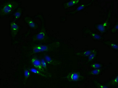 TMEM115 Antibody - Immunofluorescent analysis of Hela cells using TMEM115 Antibody at dilution of 1:100 and Alexa Fluor 488-congugated AffiniPure Goat Anti-Rabbit IgG(H+L)