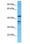 TMEM116 Antibody - TMEM116 antibody Western Blot of NCI-H226. Antibody dilution: 1 ug/ml.  This image was taken for the unconjugated form of this product. Other forms have not been tested.