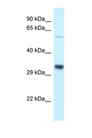 TMEM117 Antibody - TMEM117 antibody Western blot of Rat Liver lysate. Antibody concentration 1 ug/ml.  This image was taken for the unconjugated form of this product. Other forms have not been tested.