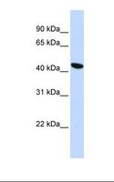 TMEM117 Antibody - HepG2 cell lysate. Antibody concentration: 1.0 ug/ml. Gel concentration: 12%.  This image was taken for the unconjugated form of this product. Other forms have not been tested.