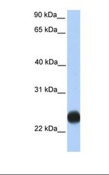 TMEM123 / Porimin Antibody - Placenta lysate. Antibody concentration: 1.0 ug/ml. Gel concentration: 12%.  This image was taken for the unconjugated form of this product. Other forms have not been tested.