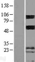 TMEM123 / Porimin Protein - Western validation with an anti-DDK antibody * L: Control HEK293 lysate R: Over-expression lysate