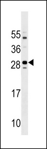 TMEM125 Antibody - Mouse Tmem125 Antibody western blot of mouse kidney tissue lysates (35 ug/lane). The Tmem125 antibody detected the Tmem125 protein (arrow).