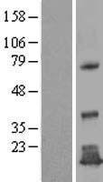 TMEM125 Protein - Western validation with an anti-DDK antibody * L: Control HEK293 lysate R: Over-expression lysate