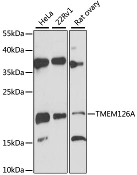 TMEM126A Antibody - Western blot analysis of extracts of various cell lines, using TMEM126A antibody at 1:3000 dilution. The secondary antibody used was an HRP Goat Anti-Rabbit IgG (H+L) at 1:10000 dilution. Lysates were loaded 25ug per lane and 3% nonfat dry milk in TBST was used for blocking. An ECL Kit was used for detection and the exposure time was 90s.