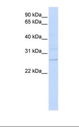 TMEM126B Antibody - MCF7 cell lysate. Antibody concentration: 1.0 ug/ml. Gel concentration: 12%.  This image was taken for the unconjugated form of this product. Other forms have not been tested.