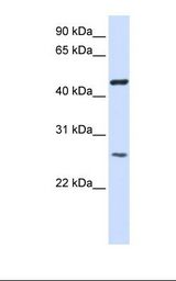 TMEM127 Antibody - Transfected 293T cell lysate. Antibody concentration: 1.0 ug/ml. Gel concentration: 12%.  This image was taken for the unconjugated form of this product. Other forms have not been tested.