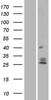 TMEM129 Protein - Western validation with an anti-DDK antibody * L: Control HEK293 lysate R: Over-expression lysate