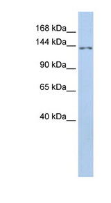 TMEM132B Antibody - TMEM132B antibody Western blot of HeLa lysate. This image was taken for the unconjugated form of this product. Other forms have not been tested.