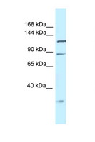 TMEM132D Antibody - Tmem132d antibody Western blot of Mouse Liver lysate. Antibody concentration 1 ug/ml.  This image was taken for the unconjugated form of this product. Other forms have not been tested.