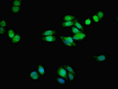 TMEM139 Antibody - Immunofluorescent analysis of HepG2 cells using TMEM139 Antibody at dilution of 1:100 and Alexa Fluor 488-congugated AffiniPure Goat Anti-Rabbit IgG(H+L)