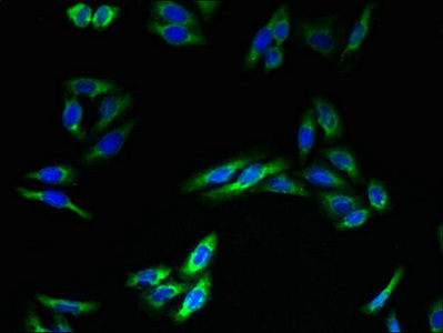 TMEM140 Antibody - Immunofluorescent analysis of HepG2 cells using TMEM140 Antibody at dilution of 1:100 and Alexa Fluor 488-congugated AffiniPure Goat Anti-Rabbit IgG(H+L)