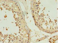 TMEM141 Antibody - Immunohistochemistry of paraffin-embedded human testis using antibody at 1:100 dilution.  This image was taken for the unconjugated form of this product. Other forms have not been tested.