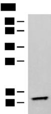 TMEM141 Antibody - Western blot analysis of Human fetal liver tissue lysate  using TMEM141 Polyclonal Antibody at dilution of 1:900