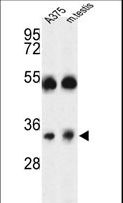 TMEM142A / ORAI1 Antibody - Western blot of ORAI1 Antibody in A375 cell line and mouse testis tissue lysates (35 ug/lane). ORAI1 (arrow) was detected using the purified antibody.