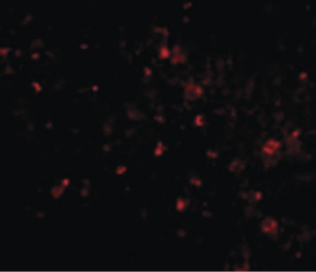 TMEM142A / ORAI1 Antibody - Immunofluorescence of ORAI1 in human spleen cells with ORAI1 antibody at 20 ug/ml.