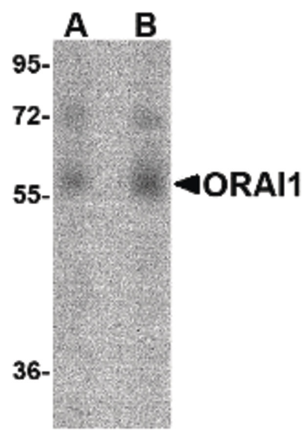 TMEM142A / ORAI1 Antibody - Western blot of ORAI1 in human ovary tissue lysate with ORAI1 antibody at (A) 1 and (B) 2 ug/ml.