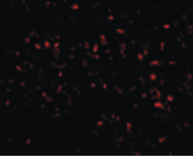 TMEM142A / ORAI1 Antibody - Immunofluorescence of ORAI1 in Human Spleen cells with ORAI1 antibody at 20 ug/ml.