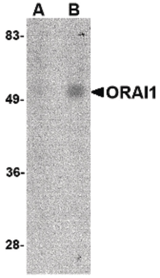 TMEM142A / ORAI1 Antibody - Western blot of ORAI1 in human spleen tissue lysate with ORAI1 antibody at (A) 1 and (B) 2 ug/ml.