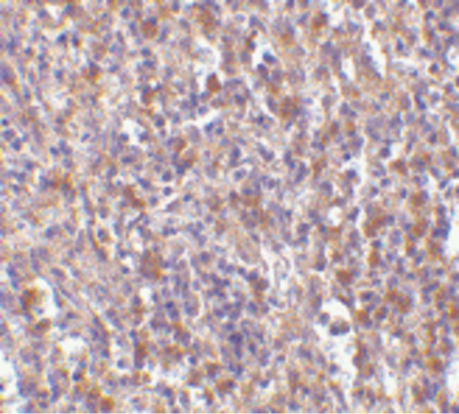 TMEM142A / ORAI1 Antibody - Immunohistochemistry of ORAI1 in human spleen tissue with ORAI1 antibody at 10 ug/ml.