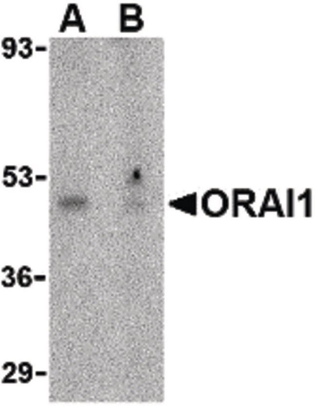 TMEM142A / ORAI1 Antibody - Western blot of ORAI1 in human ovary tissue lysate with ORAI1 antibody at 1 ug/ml in the (A) absence or (B) presence of blocking peptide.