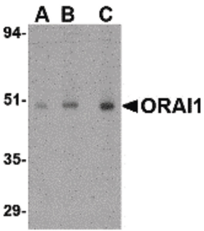 TMEM142A / ORAI1 Antibody - Western blot of ORAI1 in human ovary tissue lysate with ORAI1 antibody at (A) 0.5, (B) 1 and (C) 2 ug/ml.