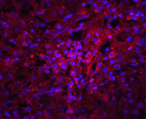 TMEM142A / ORAI1 Antibody - Immunofluorescence of ORAI1 in human ovary tissue with ORAI1 antibody at 20 ug/mL.  Red: ORAI1 Antibody  Blue: DAPI staining