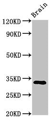 TMEM142A / ORAI1 Antibody - Positive Western Blot detected in Mouse brain tissue. All lanes: ORAI1 antibody at 3.2 µg/ml Secondary Goat polyclonal to rabbit IgG at 1/50000 dilution. Predicted band size: 33, 26 KDa. Observed band size: 33 KDa
