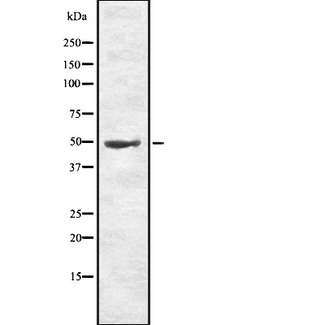 TMEM142A / ORAI1 Antibody - Western blot analysis of ORAI1 using K562 whole lysates.