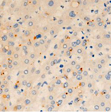 TMEM142A / ORAI1 Antibody - 1:100 staining human liver tissue by IHC-P. The tissue was formaldehyde fixed and a heat mediated antigen retrieval step in citrate buffer was performed. The tissue was then blocked and incubated with the antibody for 1.5 hours at 22°C. An HRP conjugated goat anti-rabbit antibody was used as the secondary.