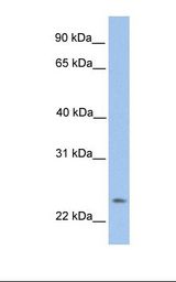 TMEM142A / ORAI1 Antibody - HepG2 cell lysate. Antibody concentration: 1.0 ug/ml. Gel concentration: 12%.  This image was taken for the unconjugated form of this product. Other forms have not been tested.