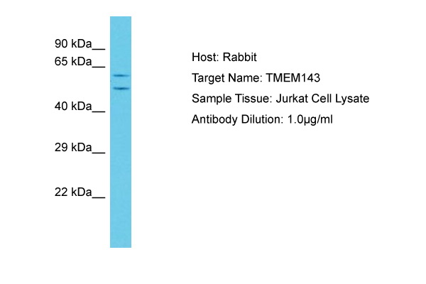 TMEM143 Antibody -  This image was taken for the unconjugated form of this product. Other forms have not been tested.