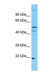 TMEM145 Antibody - Western blot of Human RPMI-8226. TMEM145 antibody dilution 1.0 ug/ml.  This image was taken for the unconjugated form of this product. Other forms have not been tested.