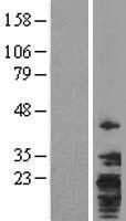 TMEM147 Protein - Western validation with an anti-DDK antibody * L: Control HEK293 lysate R: Over-expression lysate