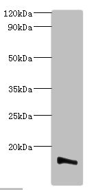 TMEM14B Antibody - Western blot All lanes: Transmembrane protein 14B antibody at 2µg/ml + K562 whole cell lysate Secondary Goat polyclonal to rabbit IgG at 1/10000 dilution Predicted band size: 13, 9 kDa Observed band size: 13 kDa