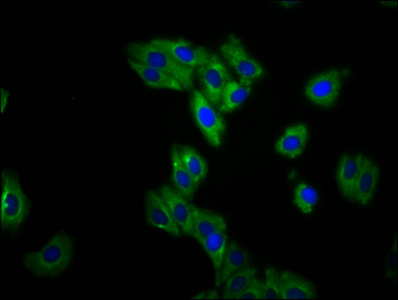 TMEM150A Antibody - Immunofluorescence staining of HepG2 cells diluted at 1:133, counter-stained with DAPI. The cells were fixed in 4% formaldehyde, permeabilized using 0.2% Triton X-100 and blocked in 10% normal Goat Serum. The cells were then incubated with the antibody overnight at 4°C.The Secondary antibody was Alexa Fluor 488-congugated AffiniPure Goat Anti-Rabbit IgG (H+L).