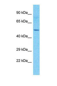 TMEM151A Antibody - Western blot of Human HepG2. TMEM151A antibody dilution 1.0 ug/ml.  This image was taken for the unconjugated form of this product. Other forms have not been tested.