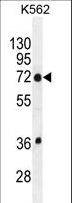 TMEM151B Antibody - TMEM151B Antibody western blot of K562 cell line lysates (35 ug/lane). The TMEM151B antibody detected the TMEM151B protein (arrow).