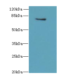 TMEM153 / LMF2 Antibody - Western blot. All lanes: LMF2 antibody at 6 ug/ml+Mos- kidney tissue Goat polyclonal to rabbit at 1:10000 dilution. Predicted band size: 80 kDa. Observed band size: 80 kDa.