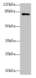 TMEM153 / LMF2 Antibody - Western blot All lanes: LMF2 antibody at 6µg/ml + Mouse kidney tissue Secondary Goat polyclonal to rabbit IgG at 1/10000 dilution Predicted band size: 80, 77, 68 kDa Observed band size: 80 kDa
