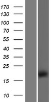 TMEM154 Protein - Western validation with an anti-DDK antibody * L: Control HEK293 lysate R: Over-expression lysate