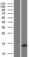 TMEM155 Protein - Western validation with an anti-DDK antibody * L: Control HEK293 lysate R: Over-expression lysate