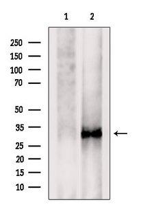 TMEM158 / RIS1 Antibody
