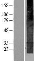 TMEM159 Protein - Western validation with an anti-DDK antibody * L: Control HEK293 lysate R: Over-expression lysate