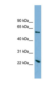 TMEM161A Antibody - TMEM161A antibody Western blot of HT1080 cell lysate. This image was taken for the unconjugated form of this product. Other forms have not been tested.