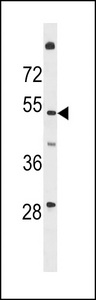 TMEM161A Antibody - T161A Antibody western blot of HL-60 cell line lysates (35 ug/lane). The T161A antibody detected the T161A protein (arrow).