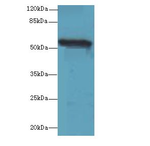 TMEM161A Antibody - Western blot. All lanes: TMEM161A antibody at 1 ug/ml+ PC-3 whole cell lysate Goat polyclonal to rabbit at 1:10000 dilution. Predicted band size: 54 kDa. Observed band size: 54 kDa.