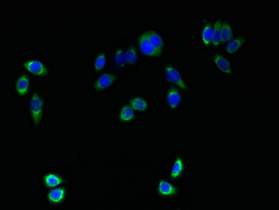 TMEM161A Antibody - Immunofluorescent analysis of PC-3 cells using TMEM161A Antibody at dilution of 1:100 and Alexa Fluor 488-congugated AffiniPure Goat Anti-Rabbit IgG(H+L)